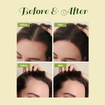 Veganic Hair Growth Oil, Veganic Natural Hair Growth Oil, Veganic Hair Oil for Hair Growth for Men and Women 2pcs