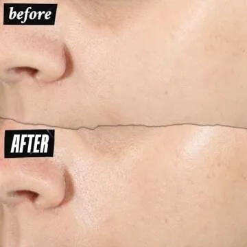 Kiehl's Ultra Pure High-Potency 1.5% Hyaluronic Acid Serum, Concentrated Face Serum for Dry Skin, Instantly Boosts Hydration, Plumps Skin, All Skin Types, Fragrance-free - 1 fl oz