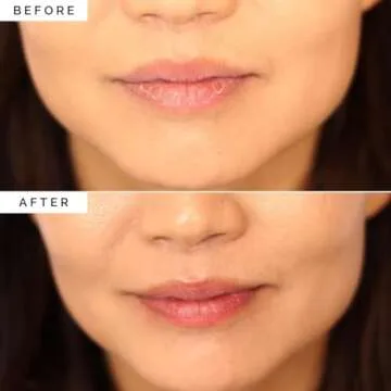 Elizabeth Mott Lip Sleeping Mask – Overnight Treatment with Peptides to Repair, Hydrate & Restore Dry, Chapped, Cracked, Peeling Lips – Moisturizing Collagen Balm to Soften, Smooth, Plump 0.71 oz