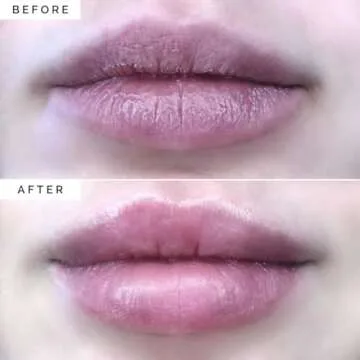 Elizabeth Mott Lip Sleeping Mask – Overnight Treatment with Peptides to Repair, Hydrate & Restore Dry, Chapped, Cracked, Peeling Lips – Moisturizing Collagen Balm to Soften, Smooth, Plump 0.71 oz