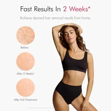 Ulike Air 10 IPL Hair Removal Device - Painless At-Home Solution