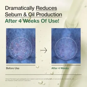 Anua Heartleaf Trio: Pore Control and Soothing Skincare