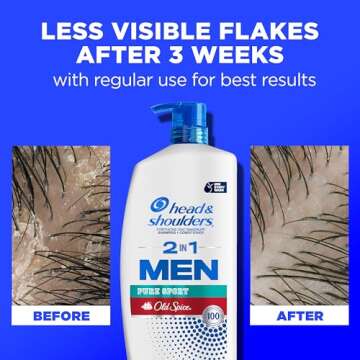 Head & Shoulders 2-in-1 Dandruff Shampoo and Conditioner Set, Clinically Proven Dandruff & Itch Relief, Lemon-Lime Scent of Old Spice Pure Sport, Nourish Scalp & Hair, 31.4 Fl Oz Each, 2 Pack