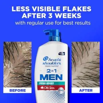 Head & Shoulders 2-in-1 Dandruff Shampoo and Conditioner Set, Clinically Proven Dandruff & Itch Relief, Lemon-Lime Scent of Old Spice Pure Sport, Nourish Scalp & Hair, 31.4 Fl Oz Each, 2 Pack