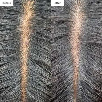 Briogeo Charcoal + Tea Tree Scalp Treatment | Revitalize Your Hair