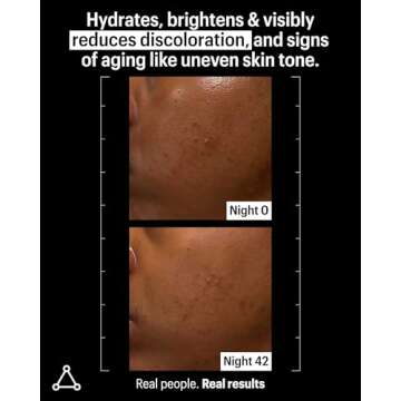 Allies of Skin Mandelic Pigmentation Corrector Night Serum: Mandelic, Lactic & Salicylic Acid, Hyaluronic Acid, Niacinamide, Bakuchiol, Rosehip & Tamanu Oils. Exfoliate & Target Uneven Skin Tone 1 oz