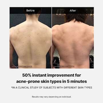 Medicube Red Acne Body Wash | Gentle Low pH Cleanser for Acne