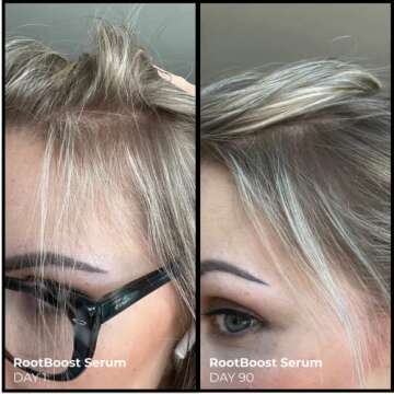 EVOLVh - Better Roots RootBoost Serum For Natural Scalp Wellness + Hair Regrowth | Vegan, Non-Toxic, Clean Hair Care (1 fl oz | 30 ml)