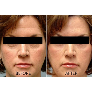 Dr. Brenner Vitamin C Serum 20% Brightening Anti Aging