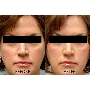 Dr. Brenner Vitamin C Serum 20% Brightening Anti Aging