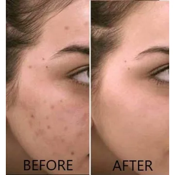 Dr. Brenner Vitamin C Serum 20% Brightening Anti Aging