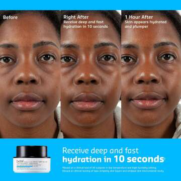 Aveeno Calm + Restore Oat Gel Moisturizer - 1.7 oz