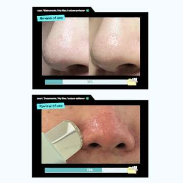 ILSO Super Melting Sebum Softener, Pore Cleansing Solution, Melts Away Blackheads & Sebum, Korean Skincare
