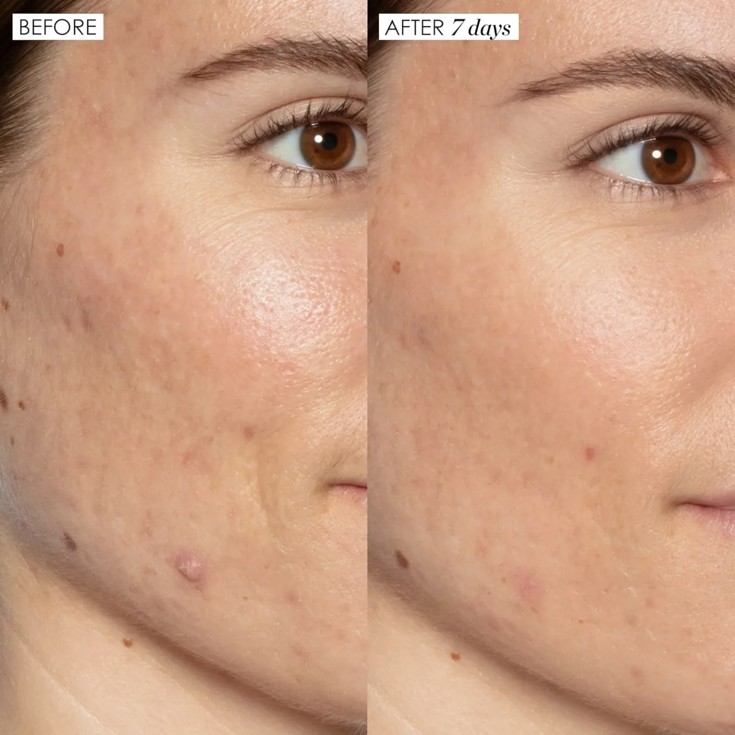 Good Genes Lactic Acid Face Serum for Radiant Skin