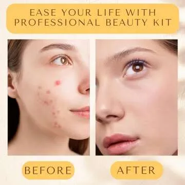 16 Pcs Blackhead Remover Tools for Flawless Skin Everywhere