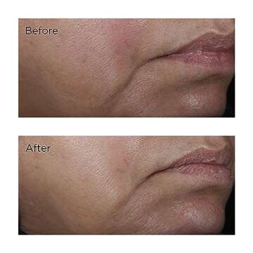 No:Rinse Intensive Pore Minimizing Toner - 4 fl. oz.