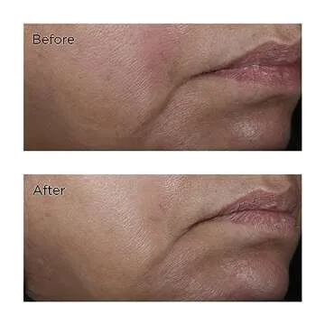 No:Rinse Intensive Pore Minimizing Toner - 4 fl. oz.