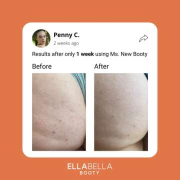 EllaBella Ms. New Booty Scrub | Smooth Skin & Acne Treatment
