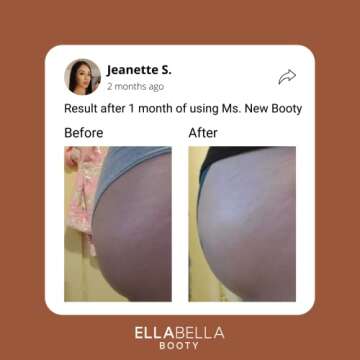 EllaBella Ms. New Booty Scrub | Smooth Skin & Acne Treatment