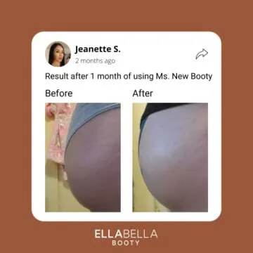 EllaBella Ms. New Booty Scrub | Smooth Skin & Acne Treatment