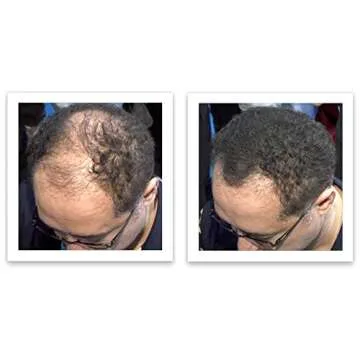 Caboki Hair Loss Concealer for Natural Hair Solutions