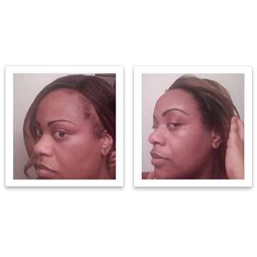 Caboki Hair Loss Concealer for Natural Hair Solutions