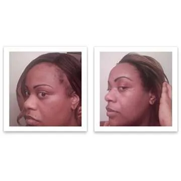 Caboki Hair Loss Concealer for Natural Hair Solutions