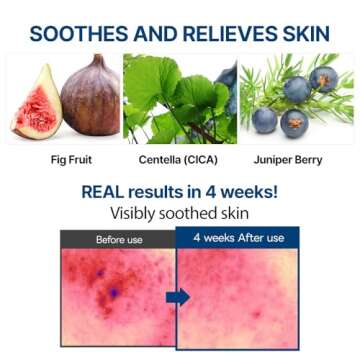 SAMU PH Sensitive Cream Mist, Centella Face Mist, Hypoallergenic Facial Spray with Hyaluronic Acid & Ceramide, Hydrating & Quick Absorbing, Korean Skin Care for Dry & Sensitive Skin, 3.38 Fl. Oz