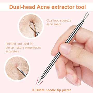 WSYUB Blackhead Tweezers, Milia Remover, Pimple Popper Tool,Ingrown Hair Tweezers, Blackhead Extractor