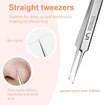 WSYUB Blackhead Tweezers, Milia Remover, Pimple Popper Tool,Ingrown Hair Tweezers, Blackhead Extractor