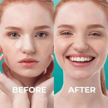 PatchRx Pimple Patches for Nose (12 Pack), Cover Nose Pimples Overnight - Hydrocolloid Acne Patches - Pimple Patch Hydrocolloid Patches & Pimple Stickers, Nose Strip, Zit Patches - Nose Pimple Patches