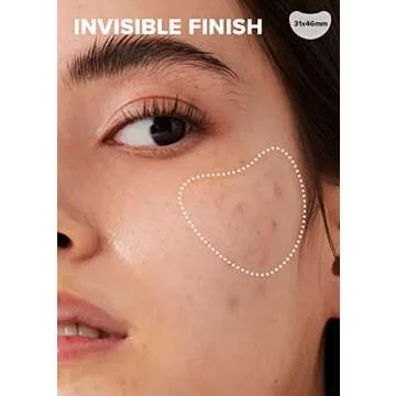 I DEW CARE Hydrocolloid Acne Pimple Patch - Timeout Blemish Chin & Cheeks | Korean zit Dark Spot Patches for face and skin, Pus absorbing with Tea Tree Leaf Oil, Trouble Remover, 9 Count