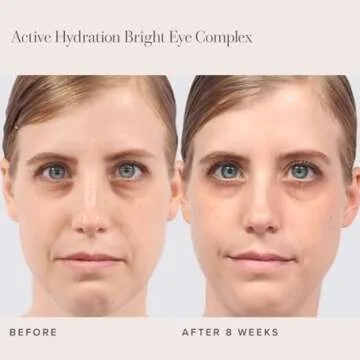 RODAN + FIELDS Active Hydration Bright Eye Complex | 15ml | Moisturizing Under Eye Cream for Dry Ski...
