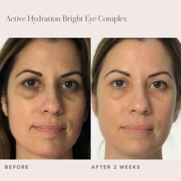 RODAN + FIELDS Active Hydration Bright Eye Complex | 15ml | Moisturizing Under Eye Cream for Dry Skin | Eye Treatment for Refreshed Appearance | Skincare