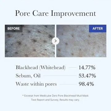 Medicube Zero Pore Mud Mask for Clear Skin
