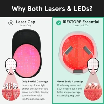 iRestore Laser Hair Growth System for Men and Women - FDA Cleared