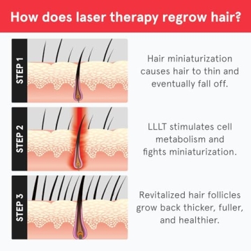 iRestore Laser Hair Growth System for Men and Women - FDA Cleared