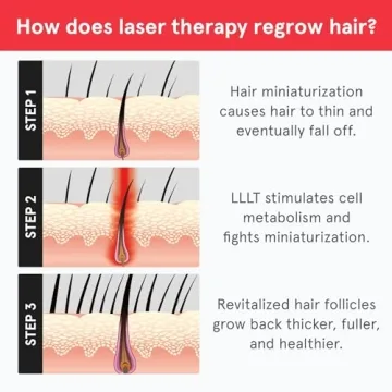 iRestore Laser Hair Growth System for Men and Women - FDA Cleared