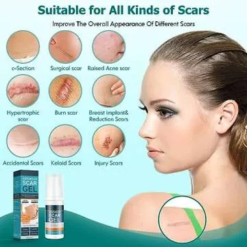 Gowgaw Advanced Silicone Scar Gel for All Scars 1.76oz
