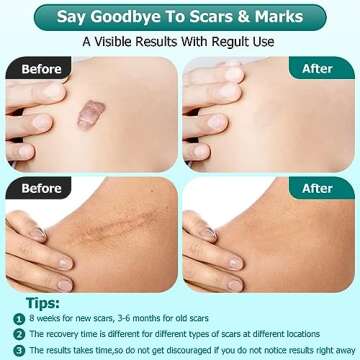 Gowgaw Scar Gel, Scar Cream, Advance Scar Gel for Surgical Scars,Face,Body,Leg, Burns, Acene,C-Section, Stretch Marks, Keloids,Scar Gel for Old & New Scars,Scar Removal for Women Men,1.76oz