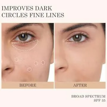 KYDA Mineral Sunscreen Eye Cream, 3-in-1 Anti-Aging Eye Cream, SPF 35, for Dark Circle and Fine Lines, Medium