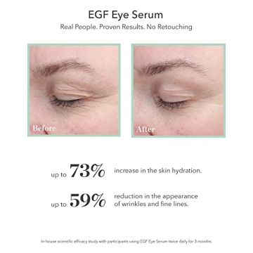 BIOEFFECT EGF Eye Serum Anti-Aging Rollerball Moisturizer