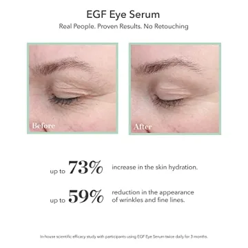 BIOEFFECT EGF Eye Serum Anti-Aging Rollerball Moisturizer