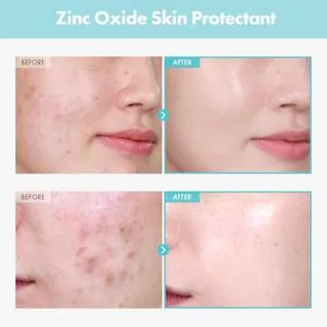 TOSOWOONG SOS Repair CICA Clinic Zinc Cream - Soothing Zinc Cream for Skin