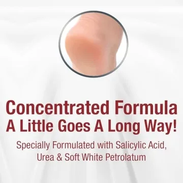 Kerasal Intensive Foot Repair Ointment for Cracked Heels