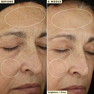 Farmacy 10% Vitamin C Face Serum - Waterless Vitamin C Skin Care Serum to Brighten, Firm + Smooth Skin Texture - Enriched with Upcycled Tangerine Peel to Boost Skin's Moisture + Radiance (5ml)