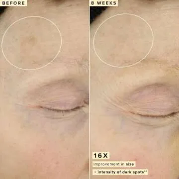 Farmacy 10% Vitamin C Face Serum - Waterless Vitamin C Skin Care Serum to Brighten, Firm + Smooth Skin Texture - Enriched with Upcycled Tangerine Peel to Boost Skin's Moisture + Radiance (5ml)