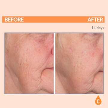 Hydrating Night Cream for Mature Skin - Serious Skincare