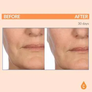 Hydrating Night Cream for Mature Skin - Serious Skincare