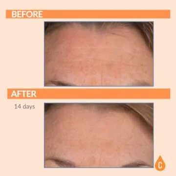 Hydrating Night Cream for Mature Skin - Serious Skincare